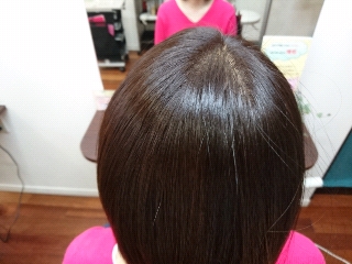 つむじ周り