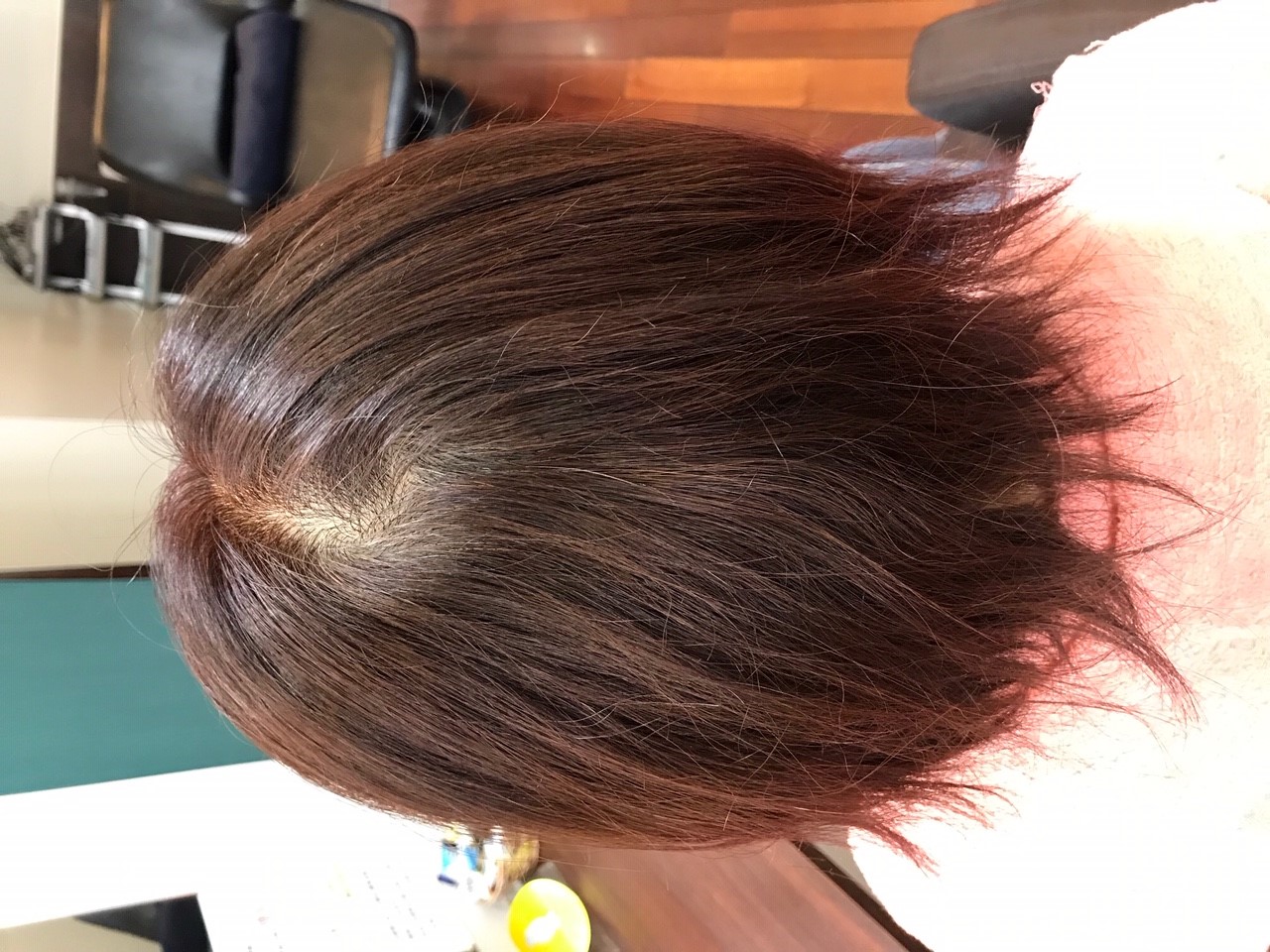 つむじが割れやすい方の施術例